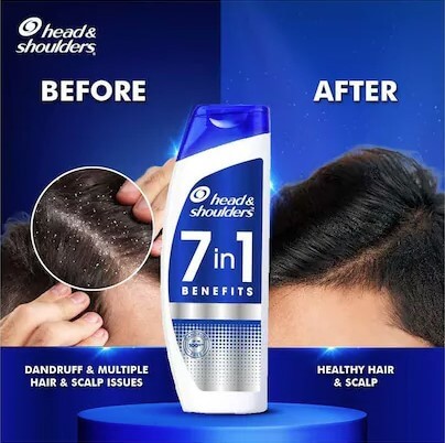 Head and Shoulders - Image 2
